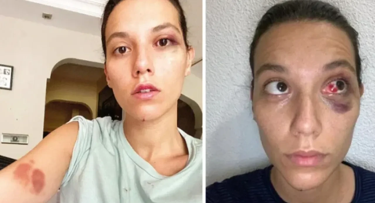 Kadıköy'de mekandan kovulmuştu: Demet Akalın'dan Ozan Güven'e destek gecikmedi