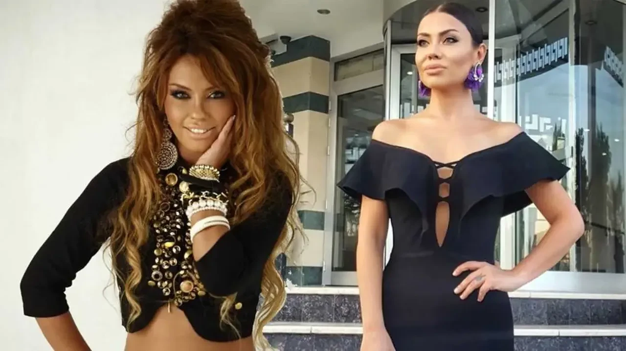 14 kilo veren şarkıcı Lara'dan çok konuşulacak estetik çıkışı! Aynı fabrikadan çıkmış gibiler