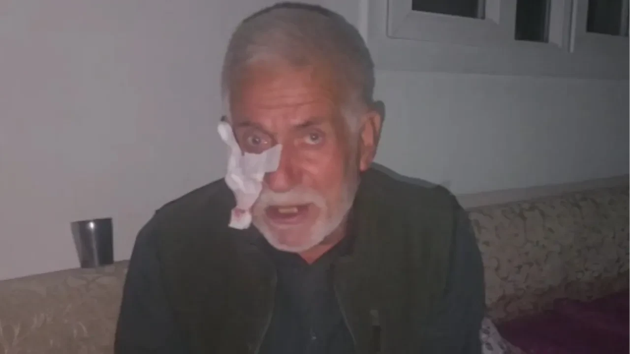 Sahipsiz köpek dehşeti: Yaşlı adamı yere serip ısırdı: 