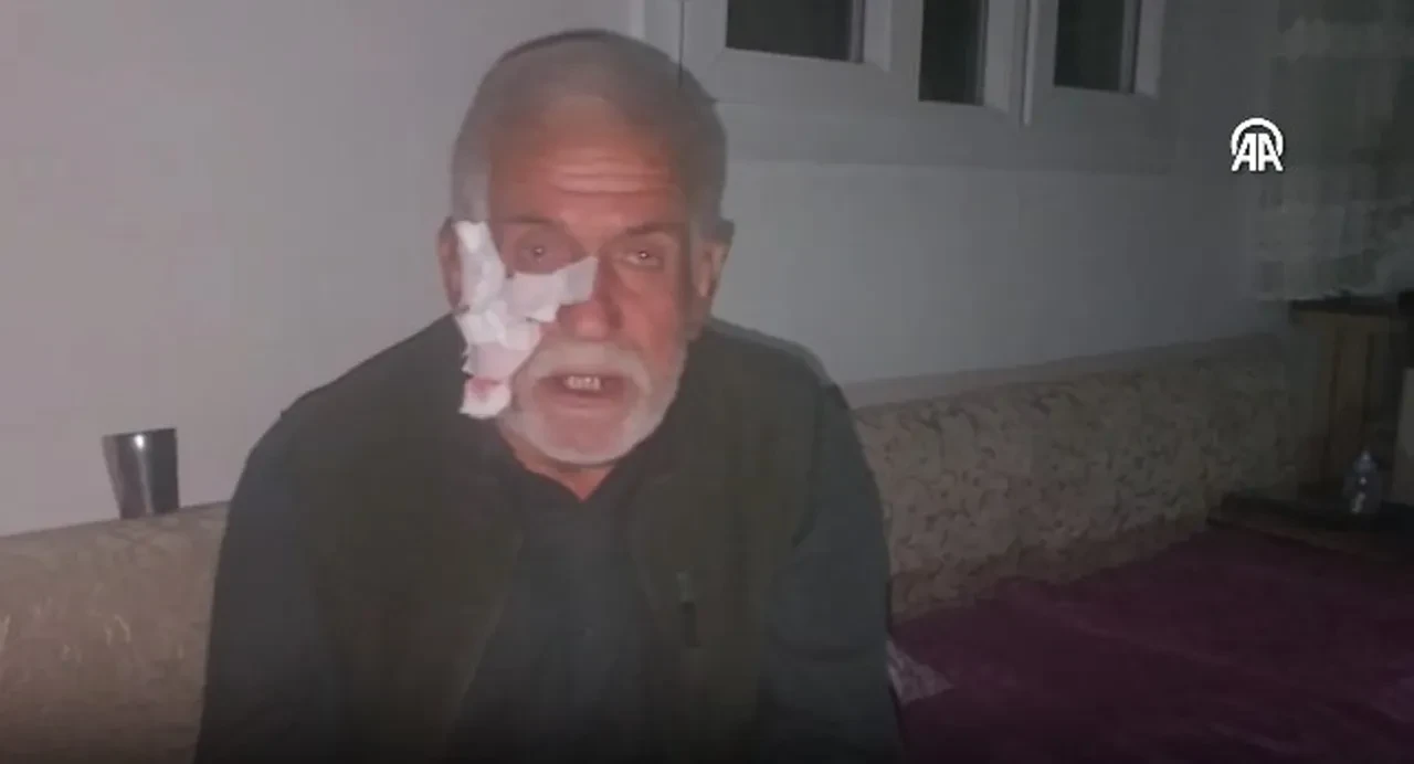 Sahipsiz köpek dehşeti! Yaşlı adamı yere serip ısırdı: "Yerimde çocuk olsaydı ölürdü"