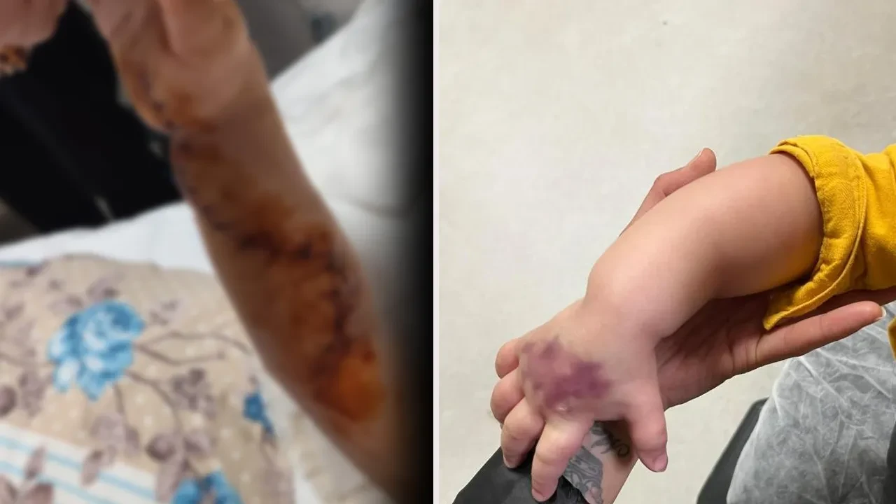 Tomografiye giren 1,5 yaşındaki çocuğun başına gelmeyen kalmadı! 