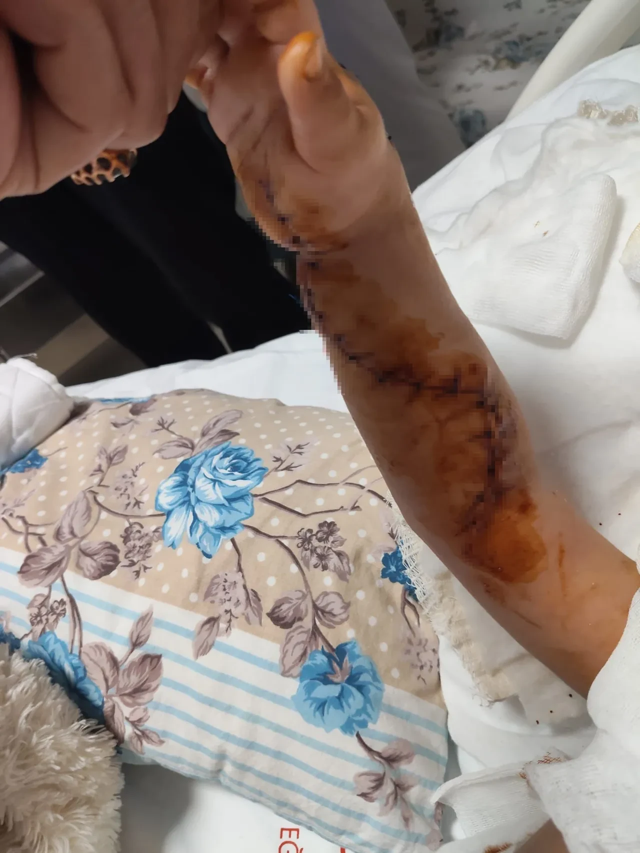 Tomografiye giren 1,5 yaşındaki çocuğun başına gelmeyen kalmadı! 