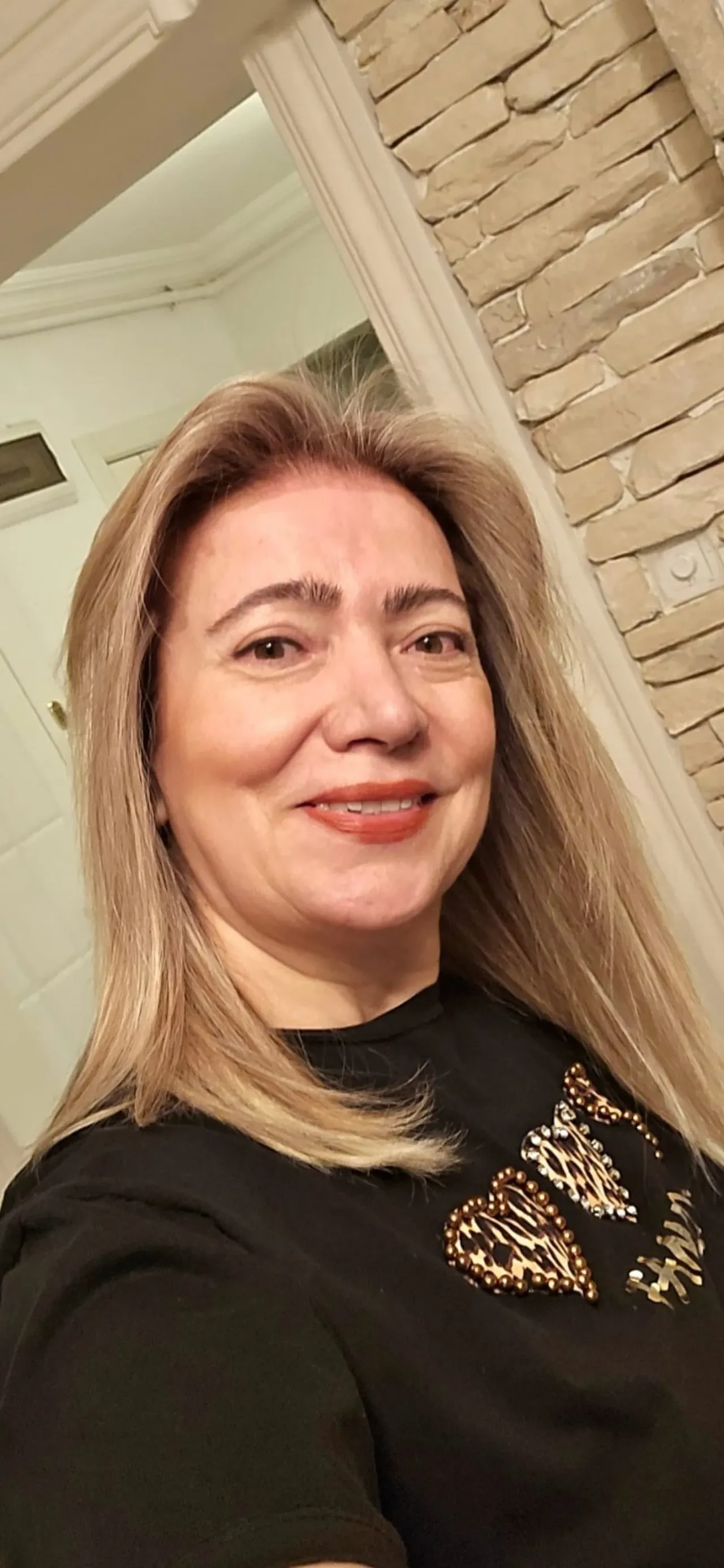 Yüzündeki kırışıklıklar için gitti, yüz felci geçirdi! Ağzı yamuldu, yüzü aşağıya sarktı 