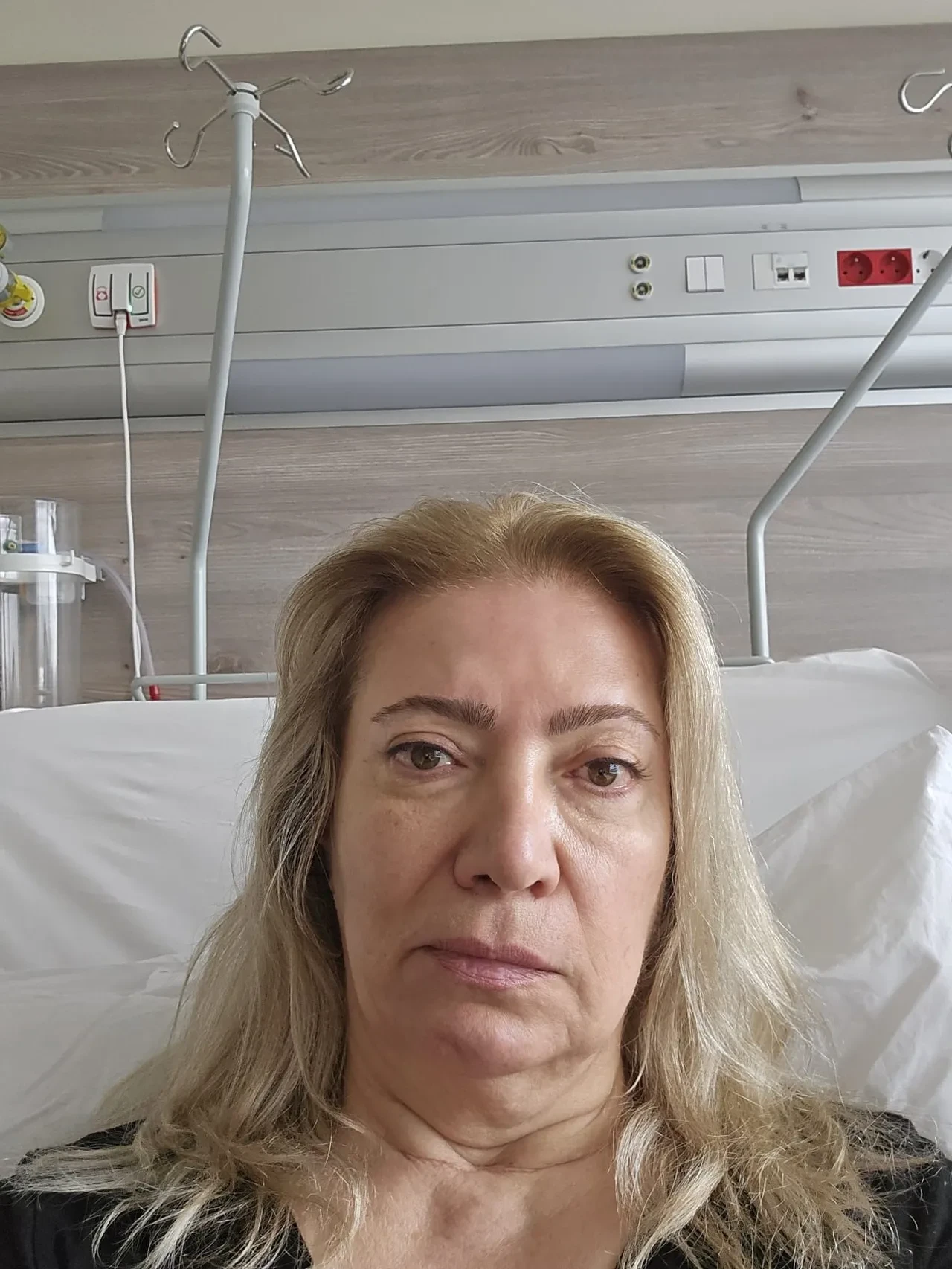 Yüzündeki kırışıklıklar için gitti, yüz felci geçirdi! Ağzı yamuldu, yüzü aşağıya sarktı 