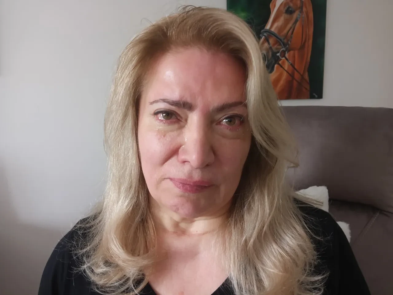 Yüzündeki kırışıklıklar için gitti, yüz felci geçirdi! Ağzı yamuldu, yüzü aşağıya sarktı 