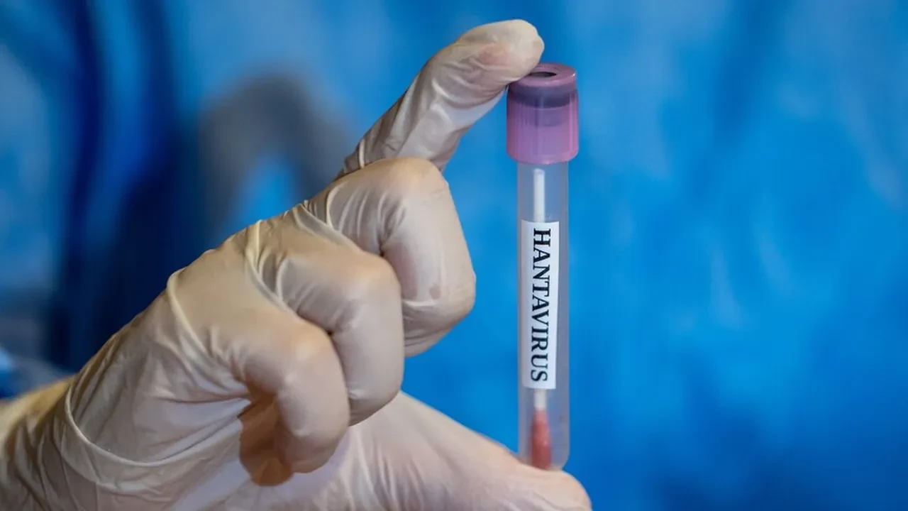 Hantavirüs pandemiye neden olur mu? Uzman isim kritik soruları cevapladı