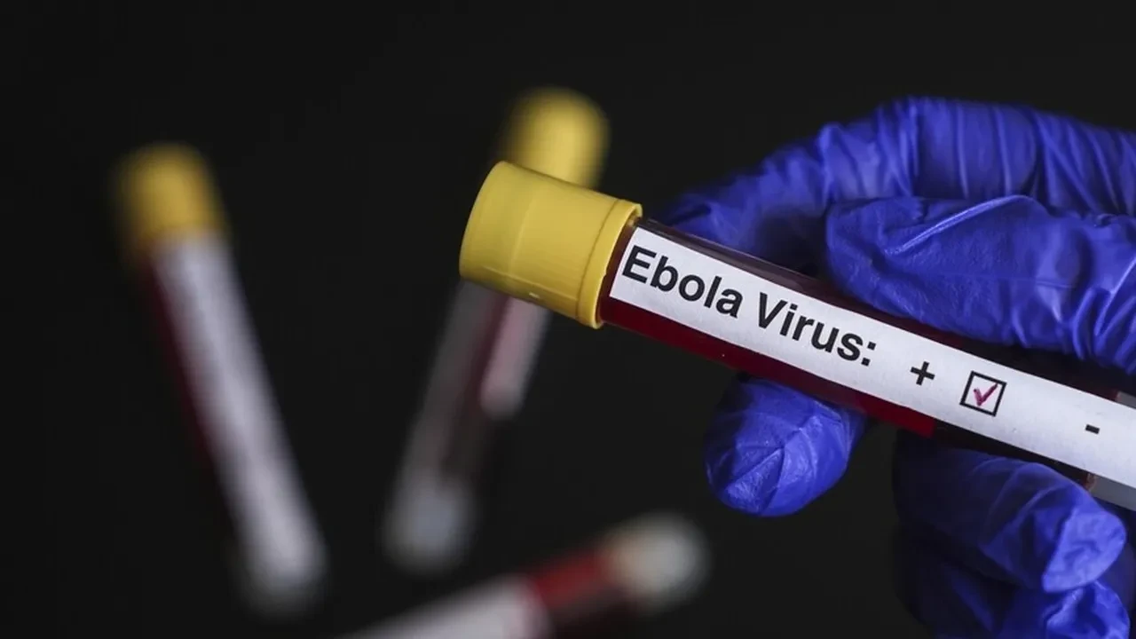 Dünya Kupası sonrası için Ebola alarmı! Oytun Erbaş'tan Türkiye için de kritik uyarı