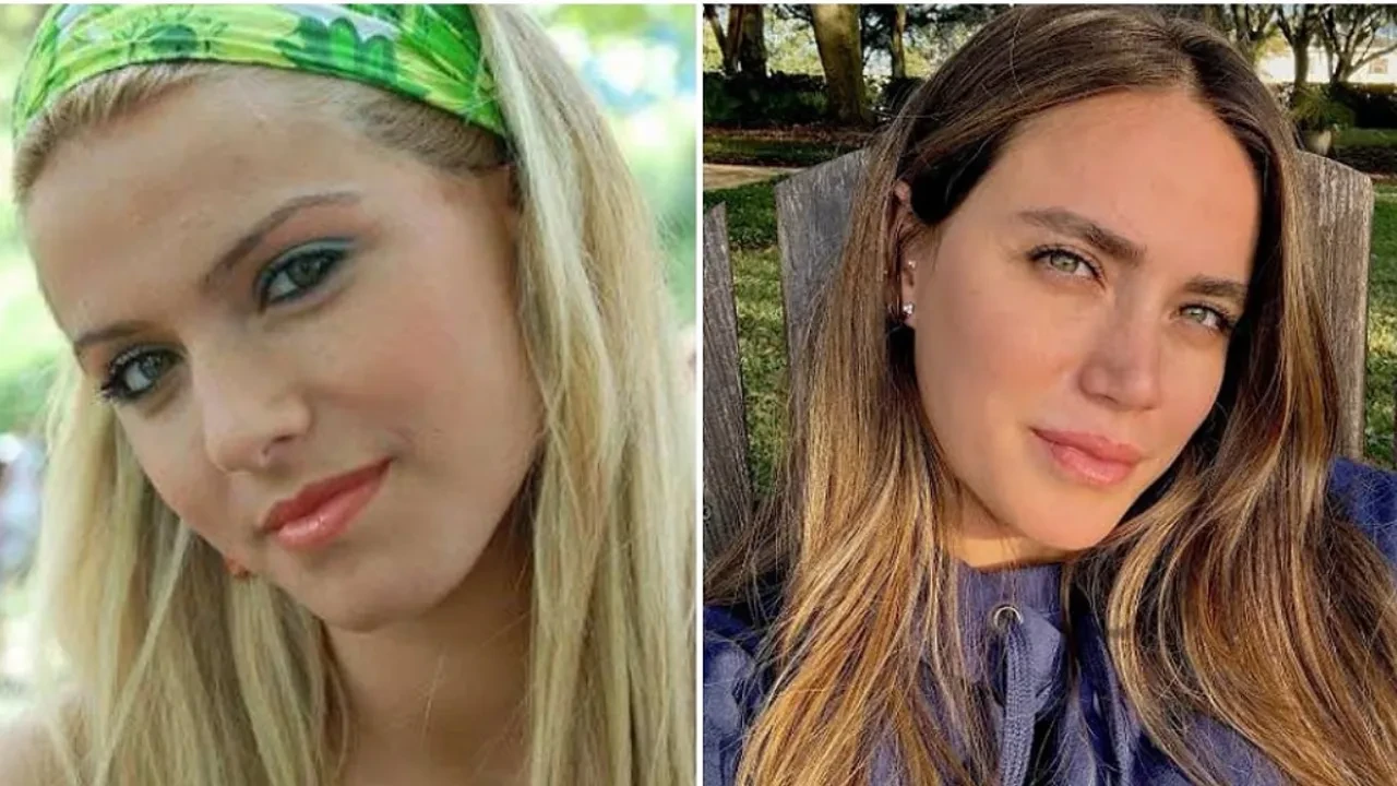 Ceyda Ateş’in yıllar önce yaşadığı kaza hayatını değiştirdi! Tam 3 kez ameliyat oldu