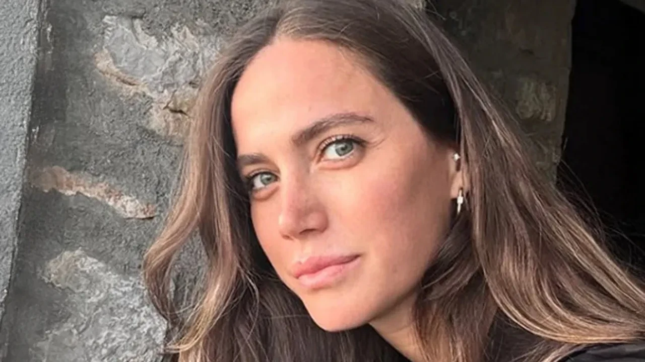 Ceyda Ateş’in yıllar önce yaşadığı kaza hayatını değiştirdi! Tam 3 kez ameliyat oldu