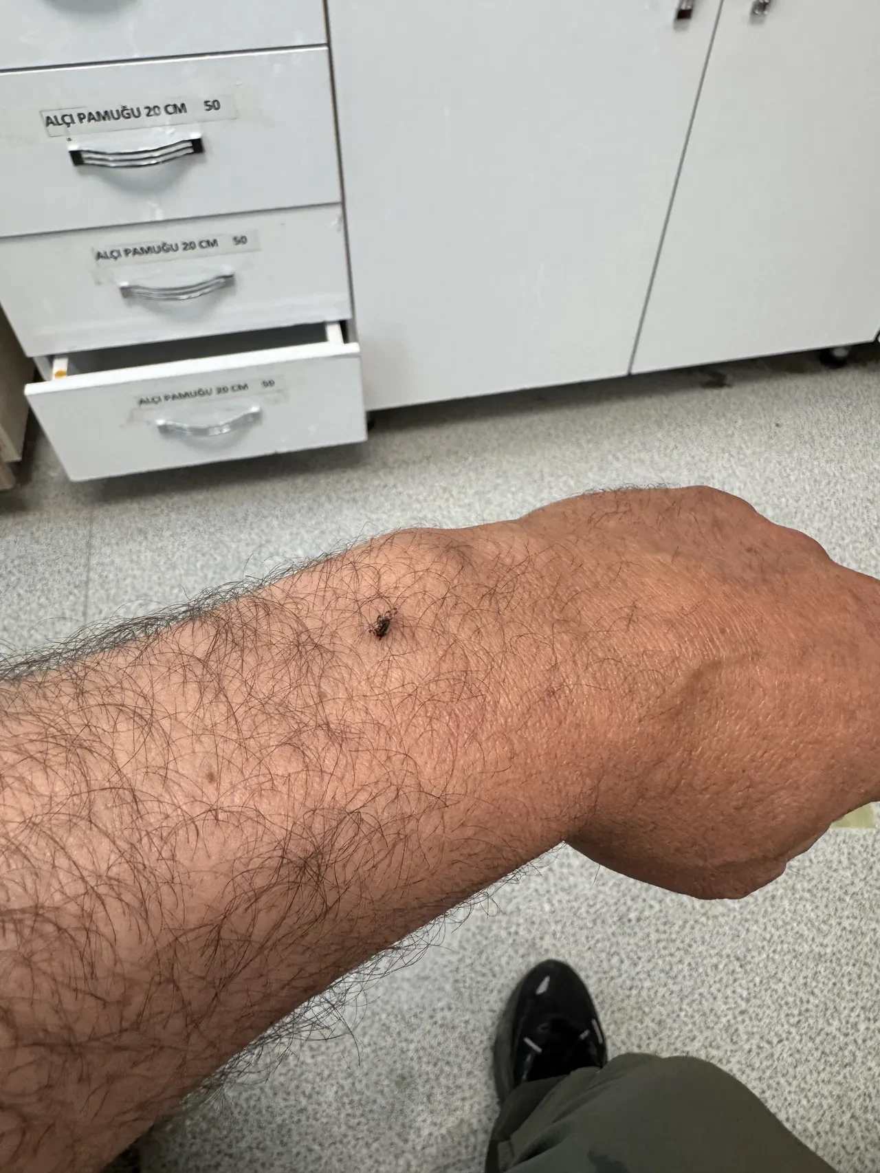 İtfaiye erinin koluna yapışan kene çıkarıldı