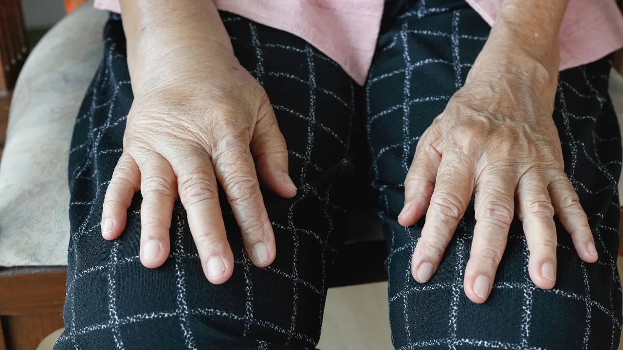 Tartıda sizi 2 kilo fazla gösteren "sodyum ödemi" nedir? 24 saatte vücuttaki gizli şişkinliği akıtan kür