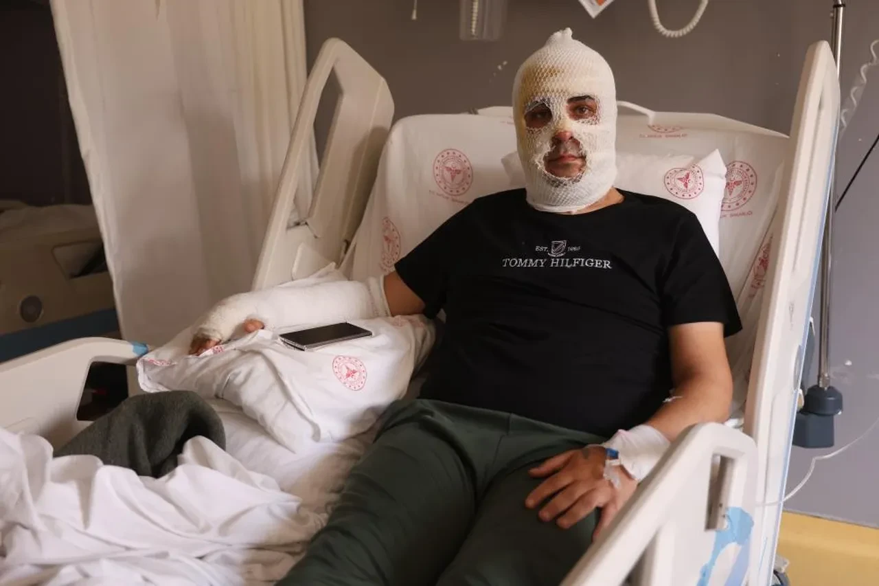 Depremzede esnafın yaşam mücadelesi yangınla karardı: Ekmek teknesi yanarken patlamada yüzü ve eli yandı!