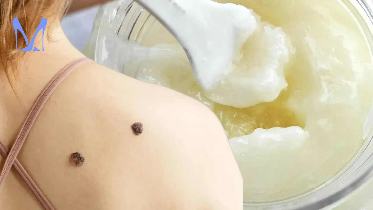 Et benlerinden muzdarip olanlar bu tarifi arıyor! Aromaterapistin 2 malzemeli karışımı viral oldu