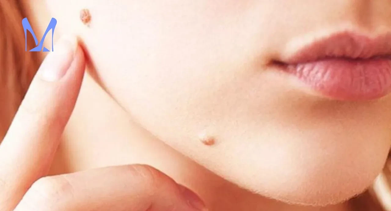 Et benlerinden muzdarip olanlar bu tarifi arıyor! Aromaterapistin 2 malzemeli karışımı viral oldu