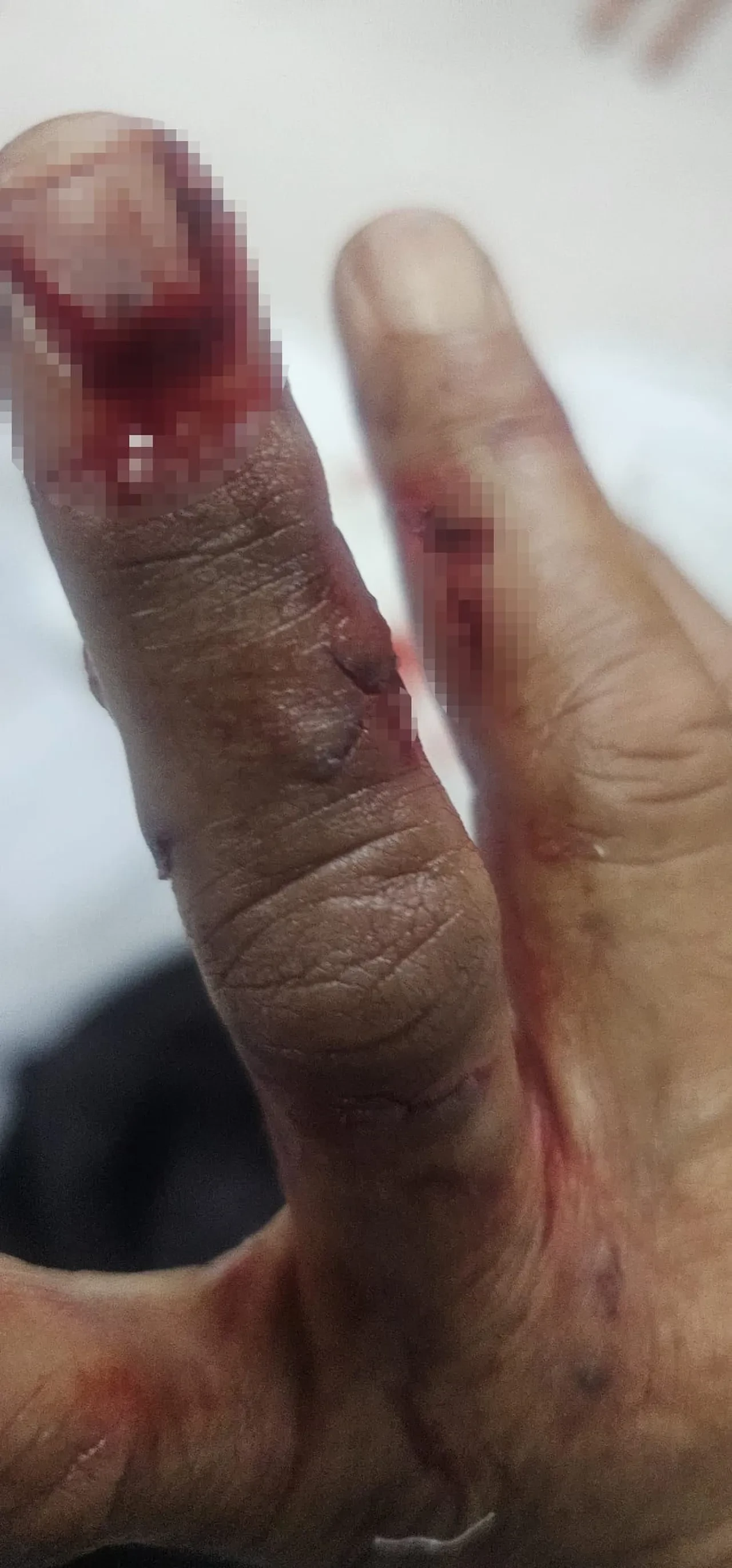 Silopi’de sokak köpeği dehşeti: 3 kadın evinin önünde vahşeti yaşadı