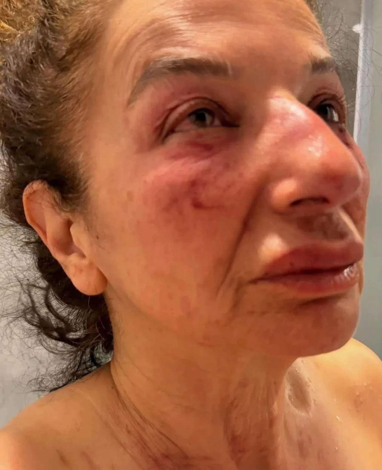 İzmir'de kan donduran vahşet: Yardım için gitti, kemerle boğulmaktan son anda kurtuldu!