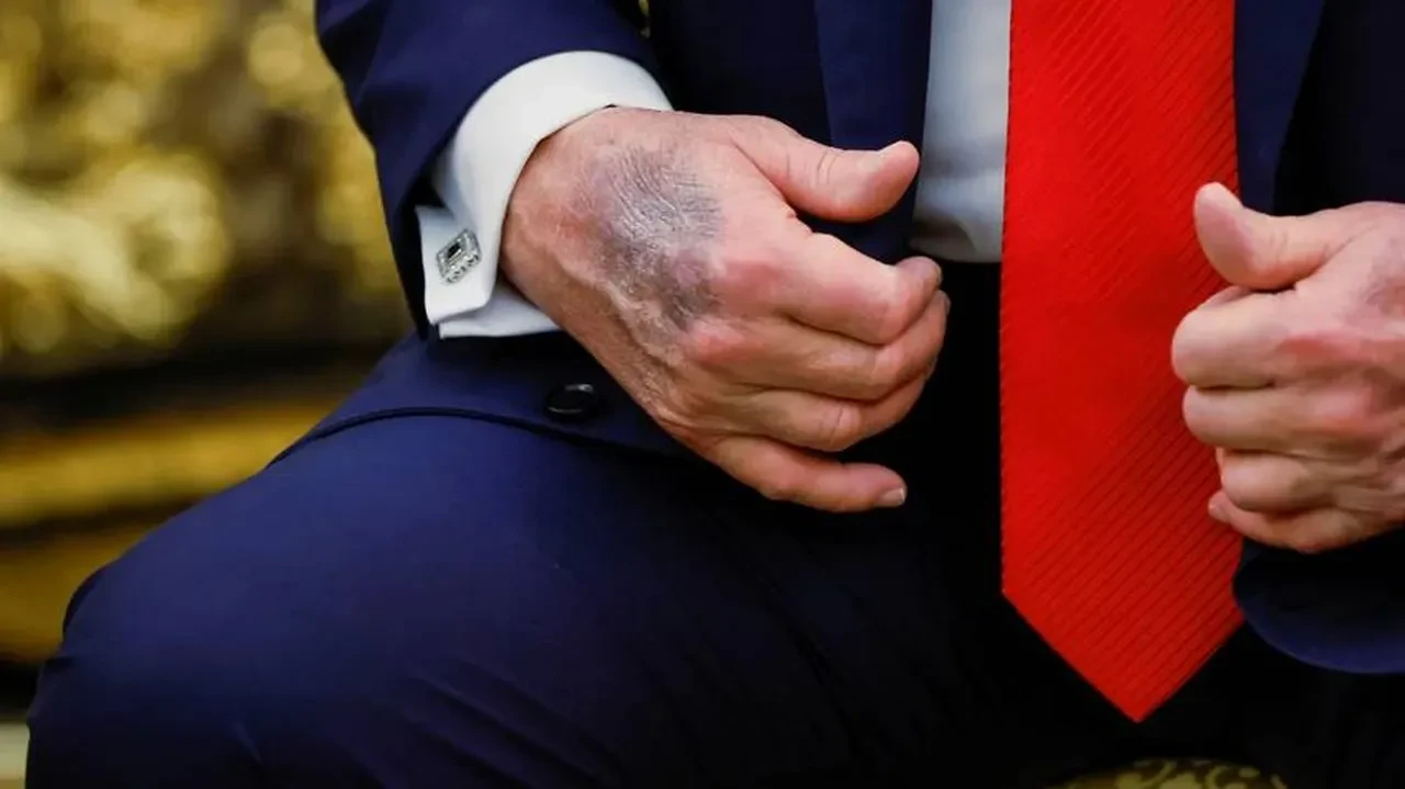 Trump'ın son sağlık durumunu Dr. Mehmet Öz açıkladı