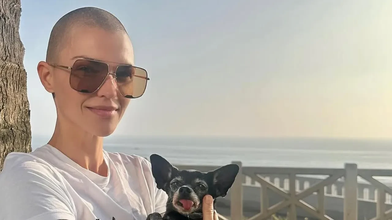 Oyuncu Ruby Rose’tan kötü haber geldi! Evinin bahçesinde yaşadığı kaza korkuttu: İki kaburgası birden