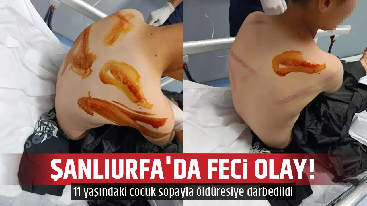 ŞANLIURFA'DA FECİ OLAY!