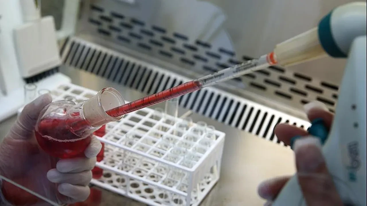 Dünyaca ünlü nörologlar tartışmaya son noktayı koydu: Kan grubunuz gizli felç riskinizi doğrudan ele veriyor!