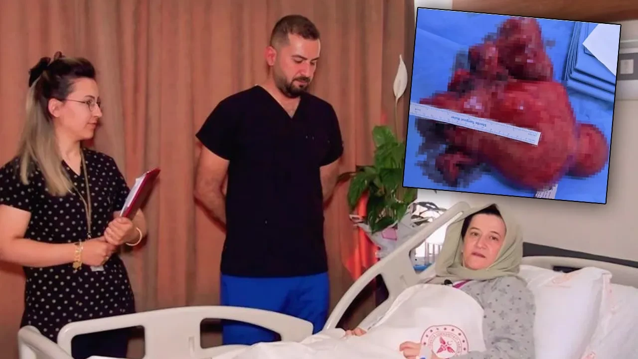 Doktorlar bile şoke oldu! Şiddetli karın ağrısı şikayetiyle gitti, dev miyom tespit edildi