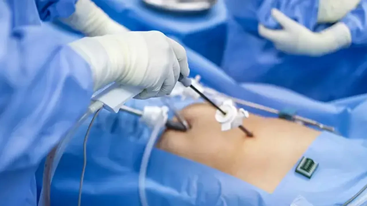 Mide ağrısıyla gitti hemen ameliyata alındı! Doktorları şaşırtan an: Tam 3 binin üzerinde karnından çıktı