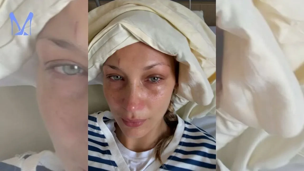 Bella Hadid'i bitiren hastalık! Gözyaşları içinde anlattı: 'Dayanamıyorum'