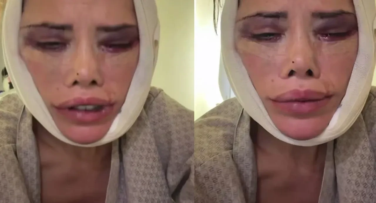 Didem Ceran gözyaşları ve ağrılar içerisinde isyan etti! 'Hakkımı helal etmiyorum'