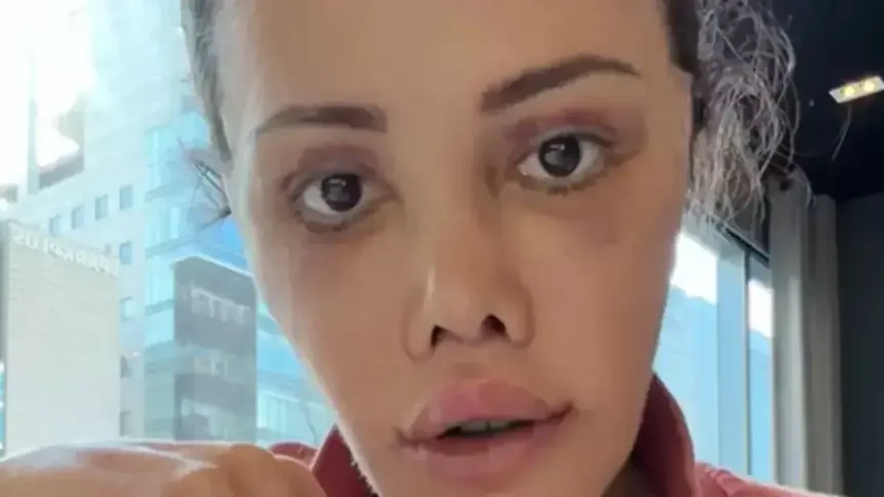 Didem Ceran gözyaşları ve ağrılar içerisinde isyan etti! 'Hakkımı helal etmiyorum'