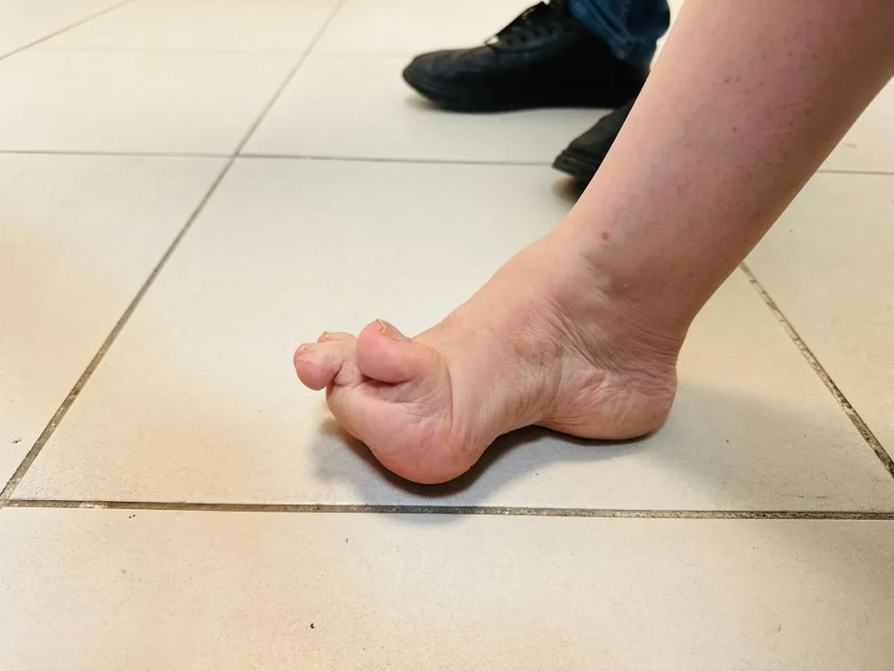 Hayatı boyunca hiç ayakkabı giyemedi: 51 yıl sonra bir ilki yaşadı