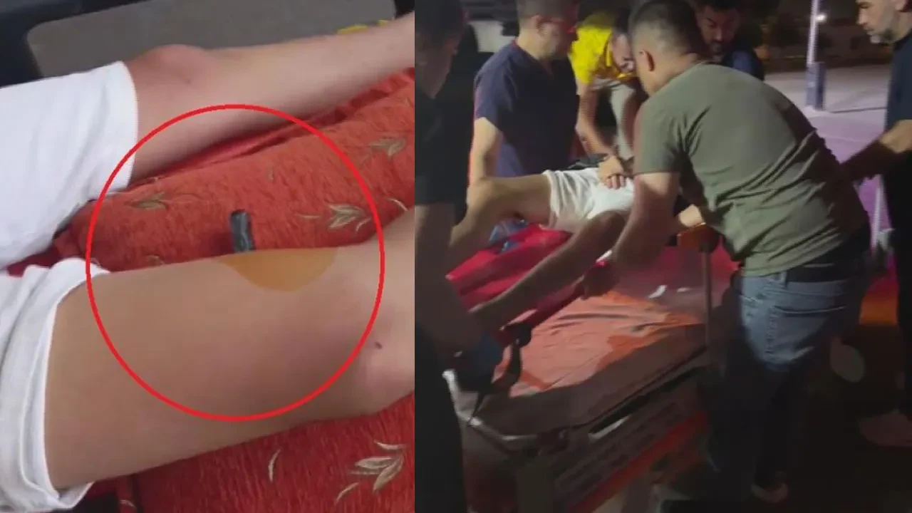 Küçük çocuğun çığlıklarını duyan mahalleli yardıma koştu! Top oynamaya çalışırken dehşeti yaşadı