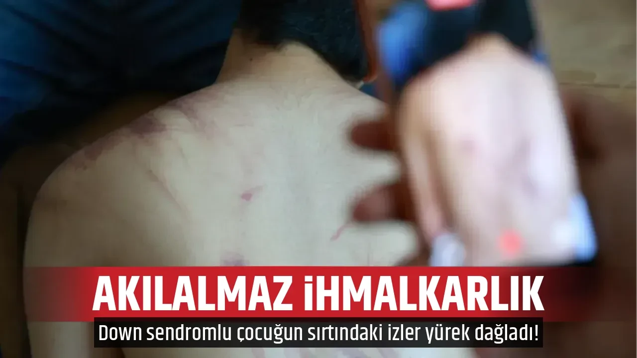 AKILALMAZ İHMALKARLIK