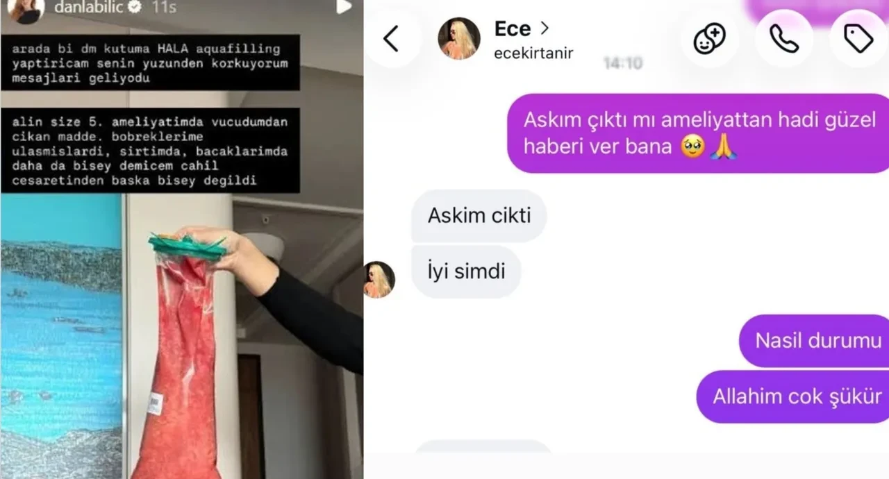 Danla Bilic korkutmuştu! Sağlık durumu hakkında son gelişme