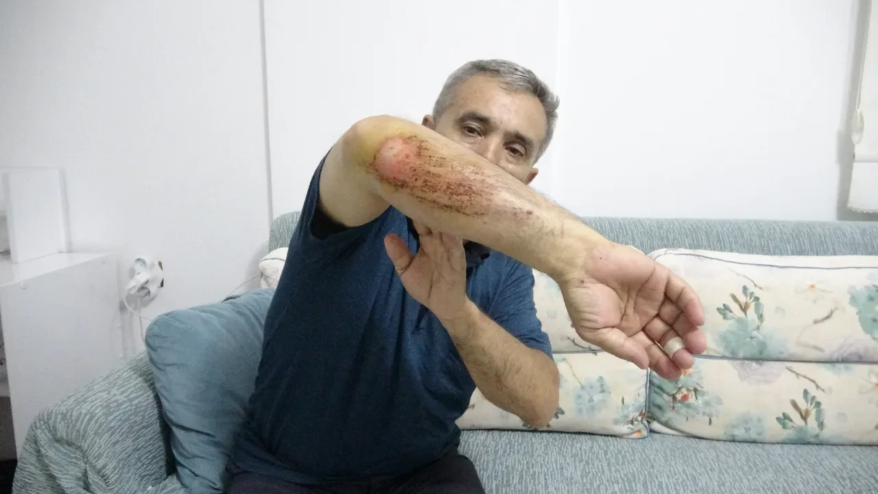 Doğa gezisi kabusa döndü! Otizmli oğluyla sahipli köpeklerin saldırısına uğradı