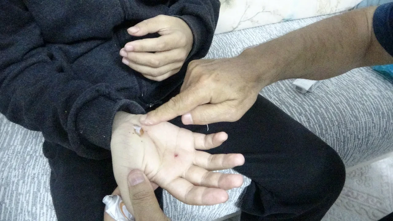 Doğa gezisi kabusa döndü! Otizmli oğluyla sahipli köpeklerin saldırısına uğradı