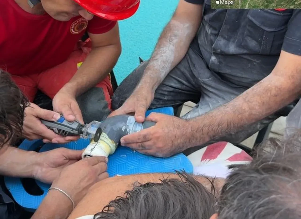 Havuzda dikkatlerden kaçan tehlike! 4 yaşındaki çocuk kolunu sıkıştırdı