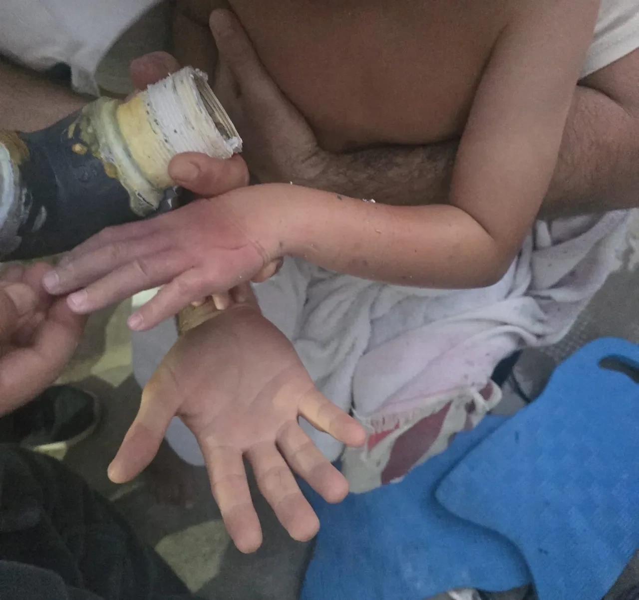 Havuzda dikkatlerden kaçan tehlike! 4 yaşındaki çocuk kolunu sıkıştırdı