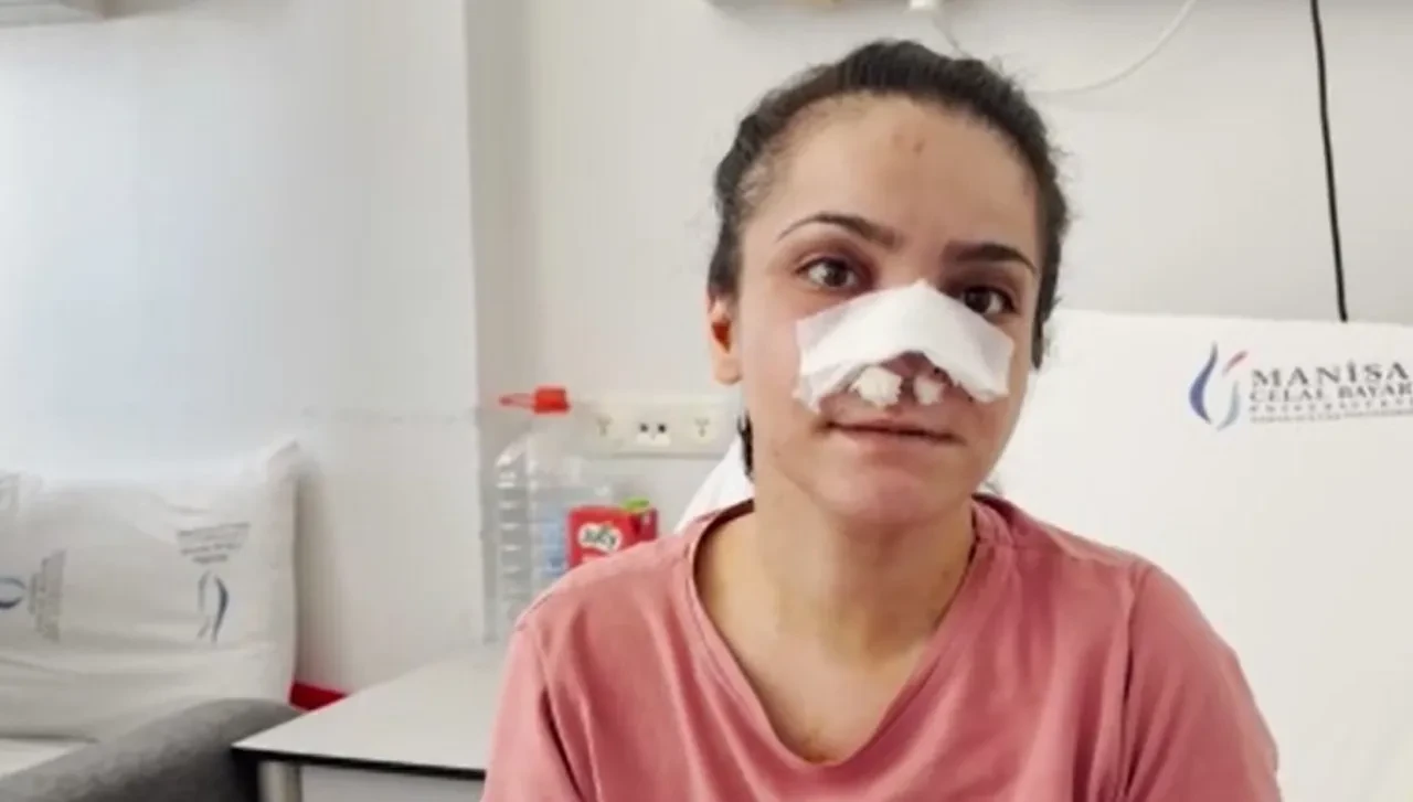 İki çocuğunun gözü önünde korkunç saldırı! Genç annenin burnunu ısırarak kopardı