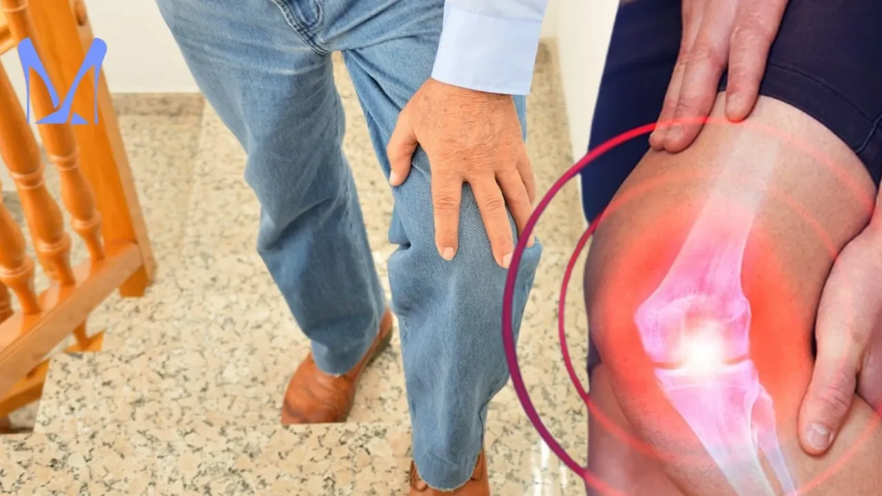 Merdiven çıkarken diziniz ağrıyorsa dikkat! Her diz kireçlenmesi protez gerektirmiyor