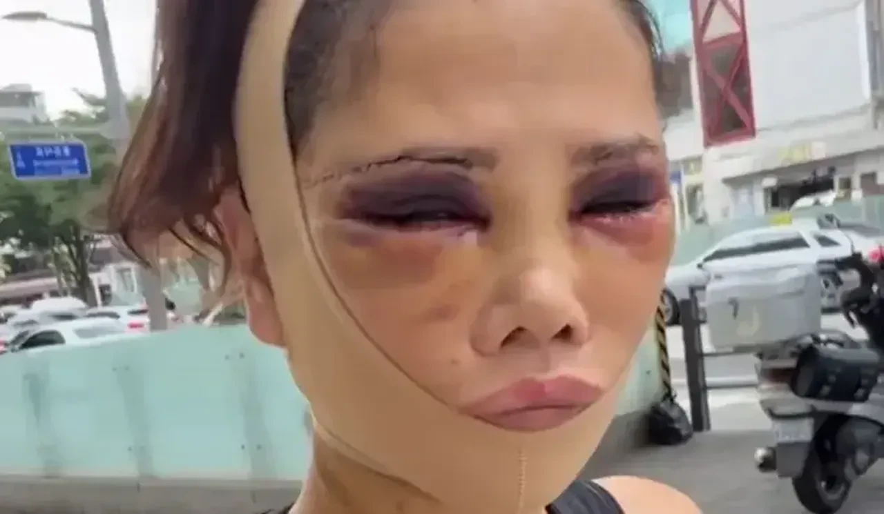 Didem Ceran'ın günler sonra ortaya çıkan son hali endişelendirdi! Katilmişim gibi davranılıyor
