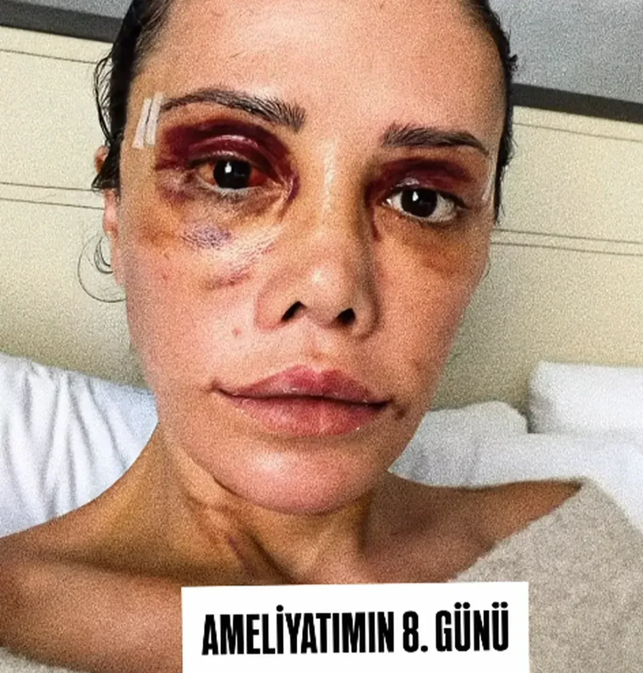 Didem Ceran'ın günler sonra ortaya çıkan son hali endişelendirdi! Katilmişim gibi davranılıyor