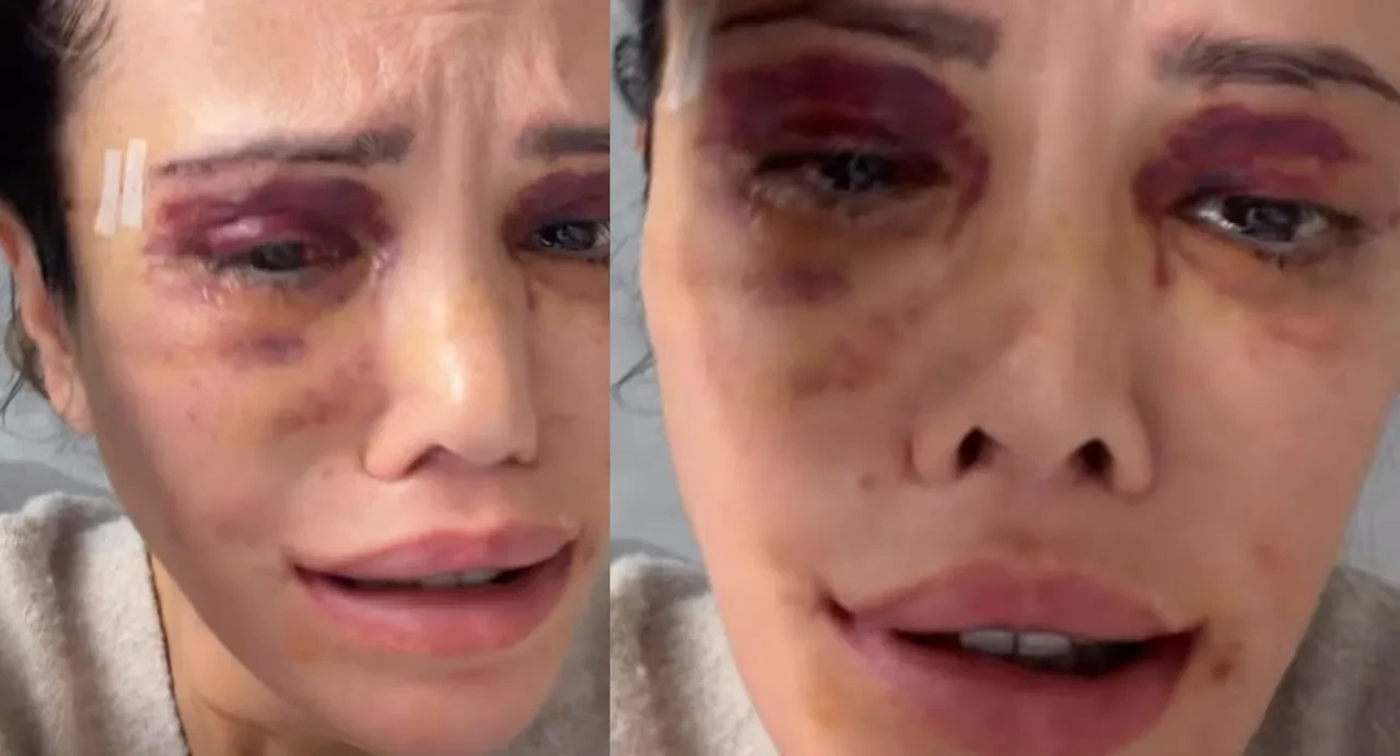 Didem Ceran'ın günler sonra ortaya çıkan son hali endişelendirdi! Katilmişim gibi davranılıyor