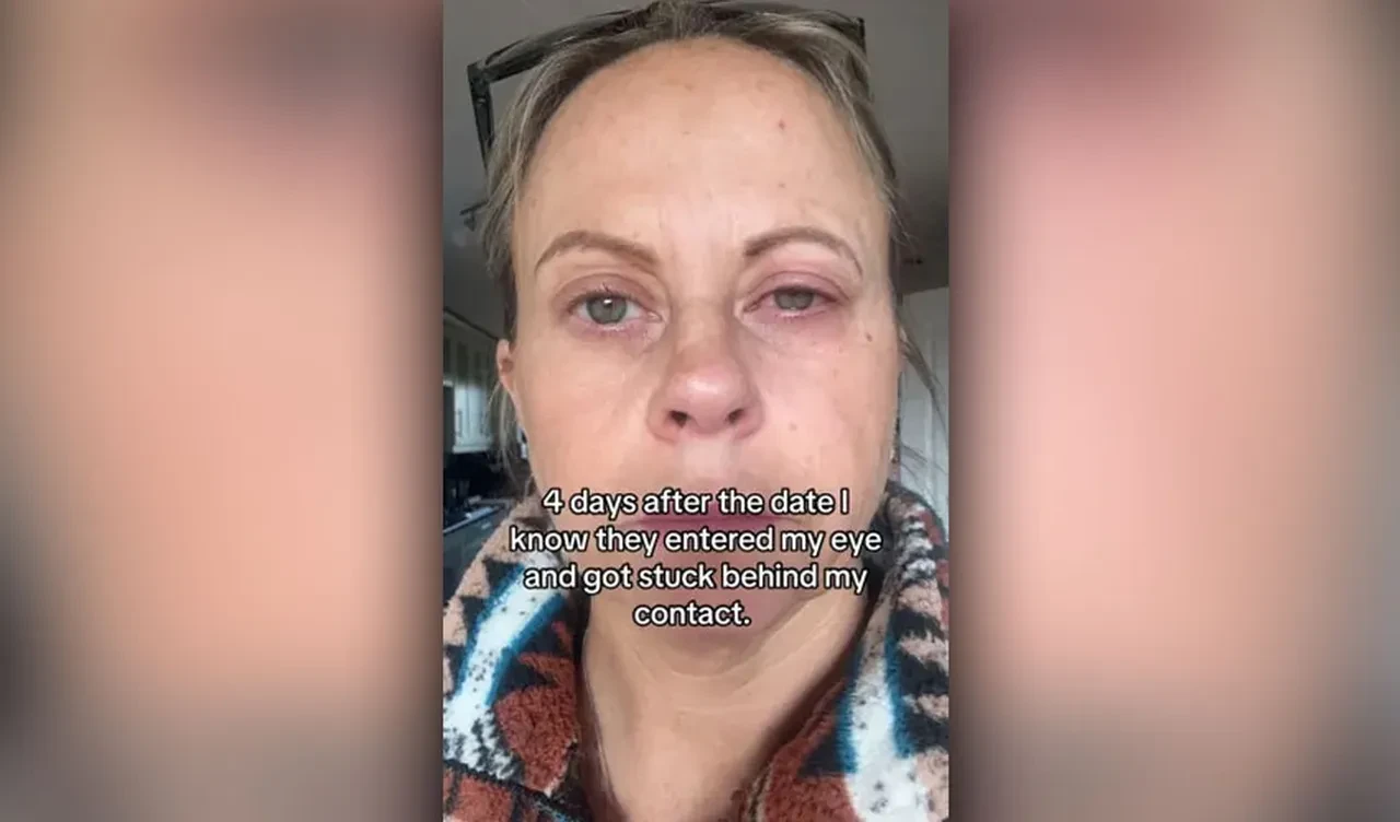 Kör olma noktasına getiren büyük hata! Göz kapağını dikmek zorunda kaldılar