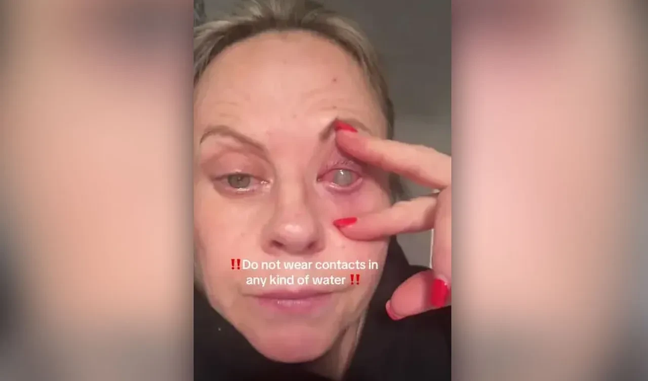 Kör olma noktasına getiren büyük hata! Göz kapağını dikmek zorunda kaldılar