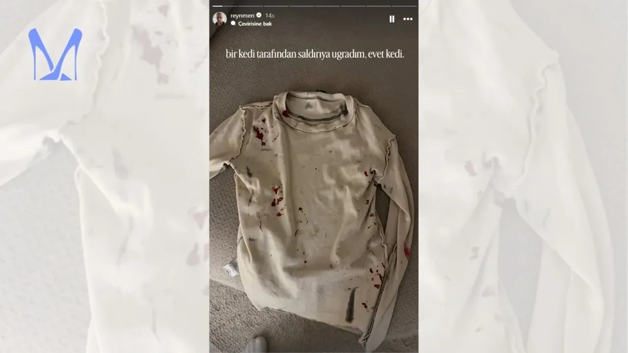 Reynmen’e kedi saldırdı! ‘Dayak yedim’ diyerek yaşadıklarını paylaştı
