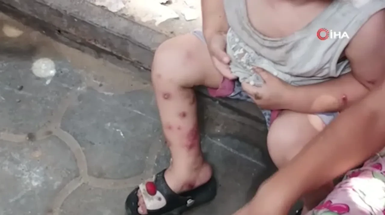 İsrail ablukasındaki Gazze'de çocuklar acı içinde! Hastalık kısa sürede yayıldı, insani şartlar yok!