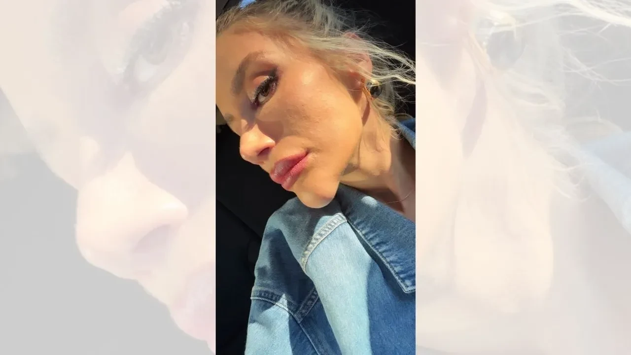 İrem Derici'nin yüzündeki şişlik dikkat çekti! Botoks olduğunu iddia eden takipçisine ise fotoğraf attı