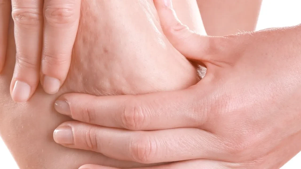Diyet yapanlar selülit ve lipödemi karıştırmayın! İşte kalın bacakların baş belası