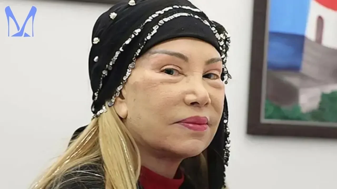 Bedia Akartürk'ün estetik sonrası değişimi gündem oldu! 4 yıl önce estetik operasyon geçirmişti!