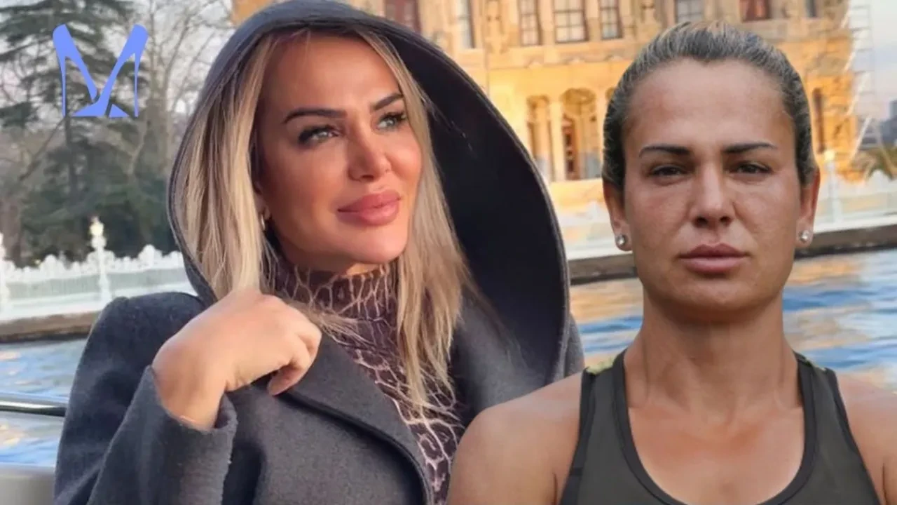 Nagihan Karadere Survivor parasını estetiğe verdi! Yüzünü komple yaptırdı